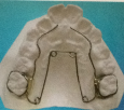 矫治器-假牙网