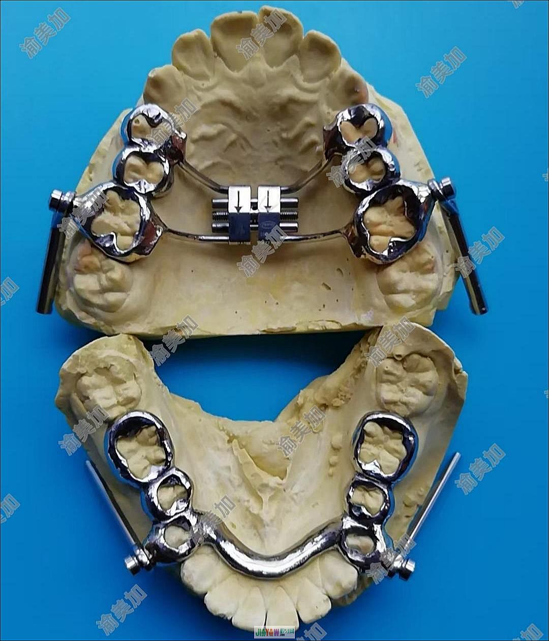 ������-������